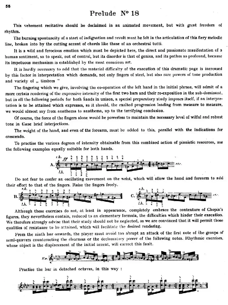 Preludes Op.28（24首前奏曲·18）